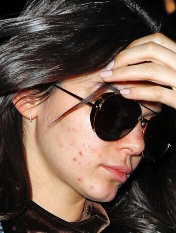 15 Latest Kendall Jenner No Makeup Images