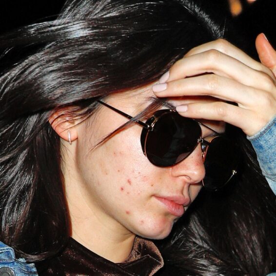 15 Latest Kendall Jenner No Makeup Images