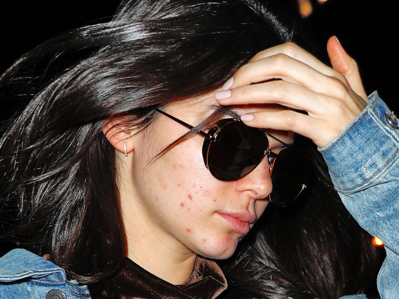 15 Latest Kendall Jenner No Makeup Images