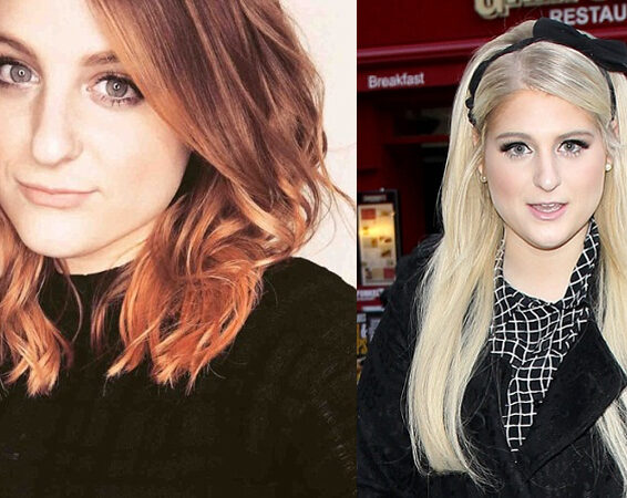 15 Photos of Meghan Trainor Without Makeup