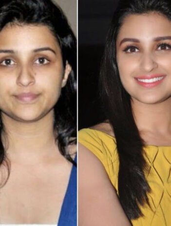 9 Unseen Photos of Parineeti Chopra Without Makeup