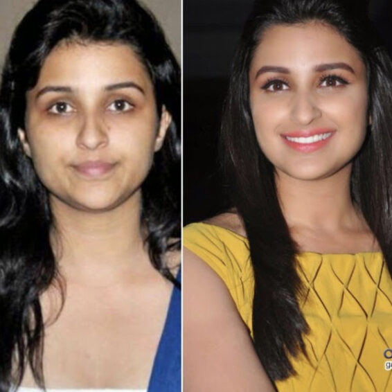 9 Unseen Photos of Parineeti Chopra Without Makeup