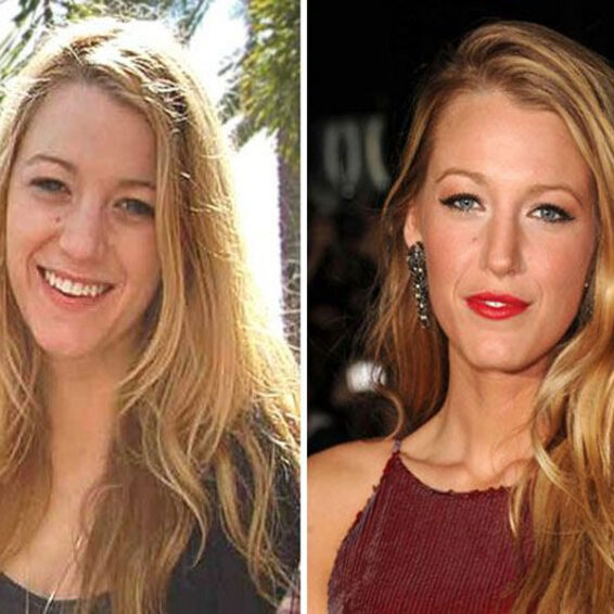 The 15 Best Photos of Blake Lively Without Makeup