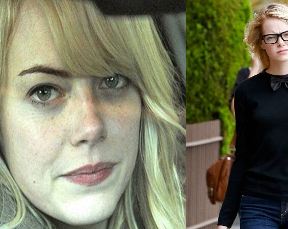 Top 10 Emma Stone Without Makeup