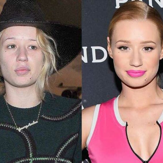 Top 15 Photos of Iggy Azalea Without Makeup